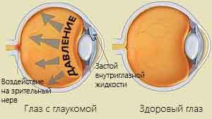 Эфирные масла улучшить зрение